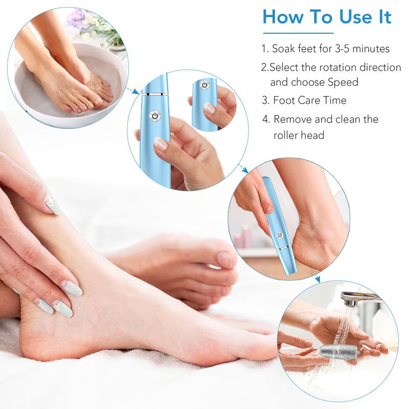 SoleSmooth Callus Buster