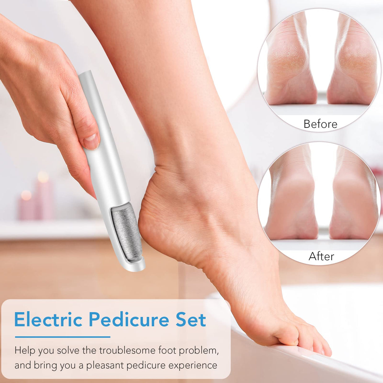 Smooth Heels Anywhere File