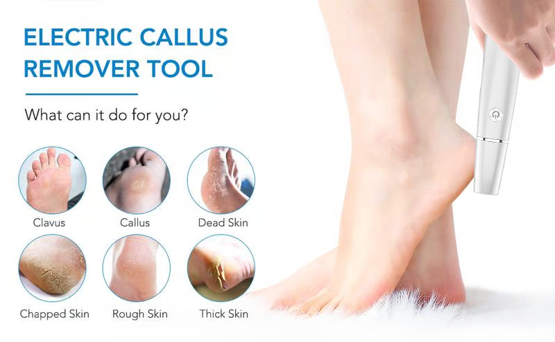 SoleSmooth Callus Buster